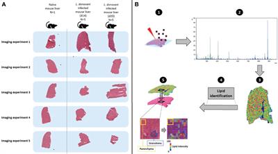 Mass spectrometry imaging identifies altered hepatic lipid signatures during experimental Leishmania donovani infection